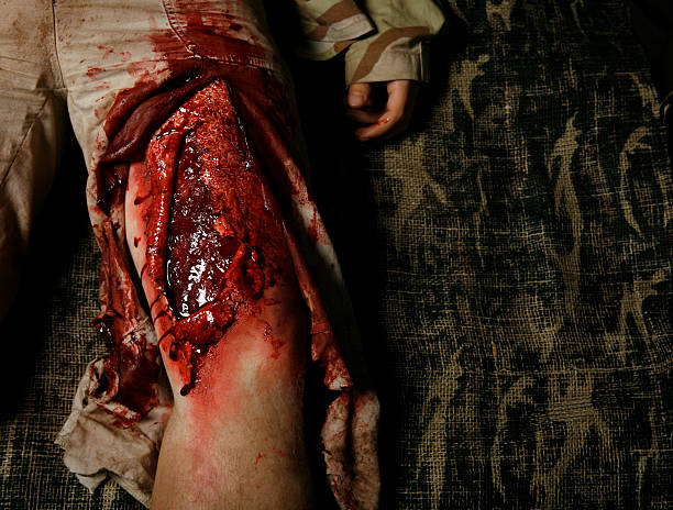 Filleted Skin *THIS IS NOT REAL - SPECIAL EFFECTS MAKE UP* Military man in desert camouflage, with Filleted Skin - approximately 25cm long wound exposing Subcutis layer of skin.  This image works for medical, military, or halloween. us military photos stock pictures, royalty-free photos & images