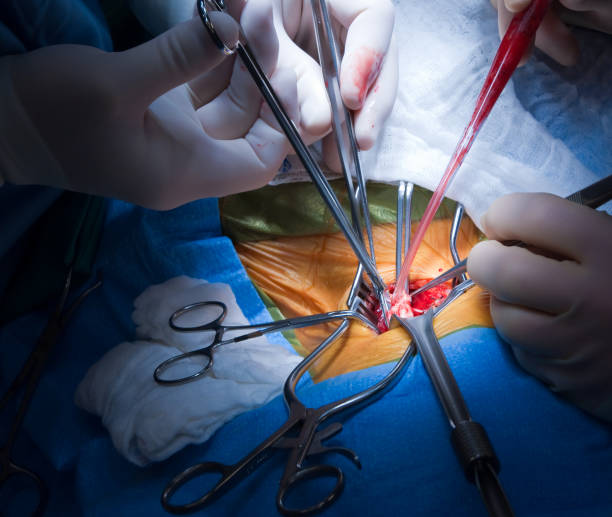 каротидная эндартерэктомия сосудистая хирургия - surgery human artery human hand carotid artery стоковые фото и изображения