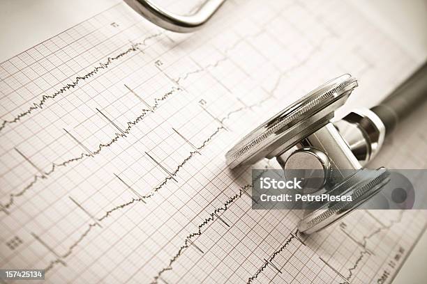 Stethoskop Auf Ein Ekg Sheetcloseup Stockfoto und mehr Bilder von Analysieren - Analysieren, Arzt, Ausrüstung und Geräte