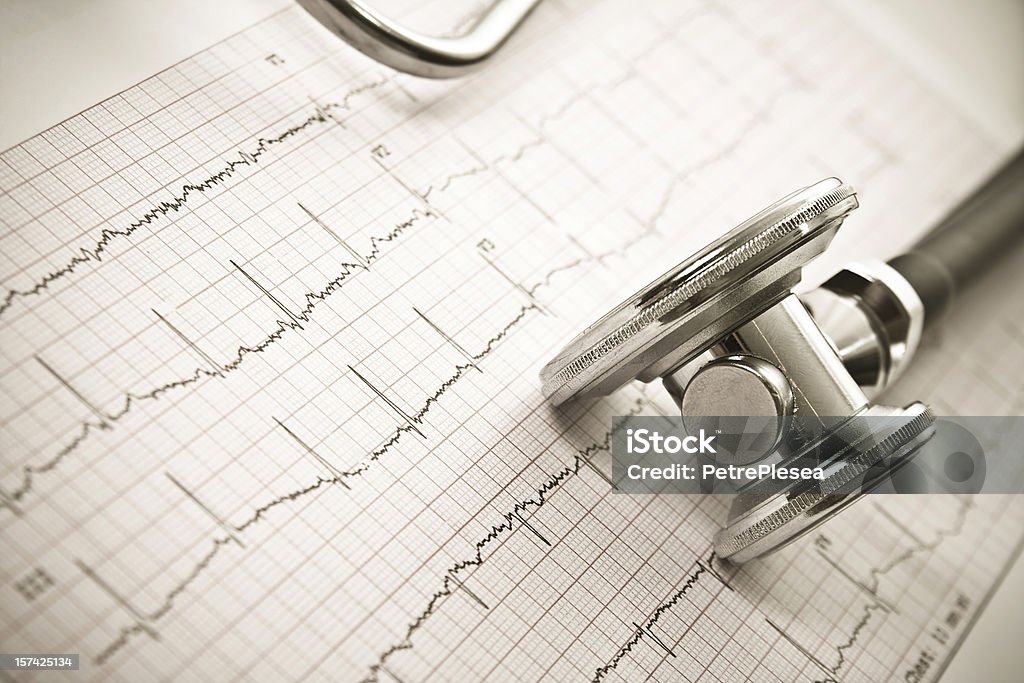 聴診器、EKG sheet.Close アップ - カラー画像のロイヤリティフリーストックフォト