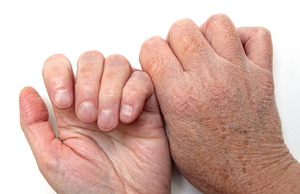 pele seca com as mãos, frente e verso - dry aged imagens e fotografias de stock