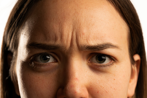 Closeup of young angry woman's wrinkles on her forehed