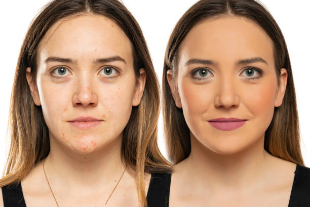 istock Comparison portrait of a woman without and with makeup 1574475629