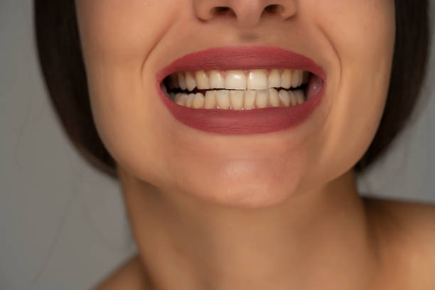 istock female smile showing healthy white teeth 1574504309
