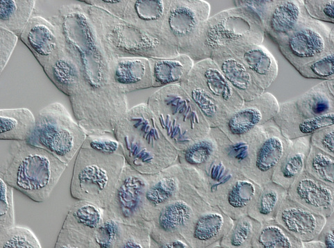 Squash preparation of stained onion root tip cells showing various stages of mitosis. Differential interference contrast optics on a Leica microscope, Image taken with the X40 objective lens.  Depth of focus is extremely shallow (just a few microns).  Differential interference contrast results in an optical slice horizontally through the specimen providing maximum possible resolution at this magnification and good contrast. Chromatic abberation is inevitable in light microscopy, but has been kept to a minimum in this image.