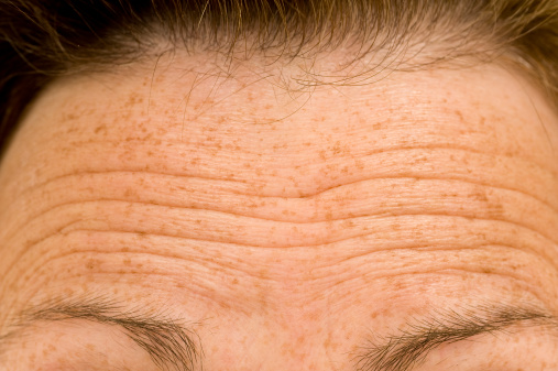 Lots of wrinkles indicate a concerned or worried person.