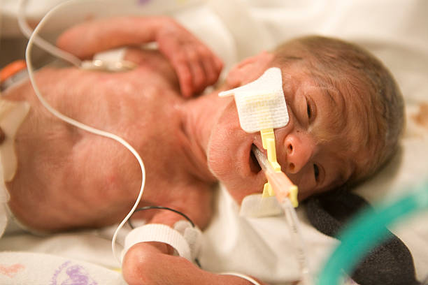Premature Baby Boy stock photo