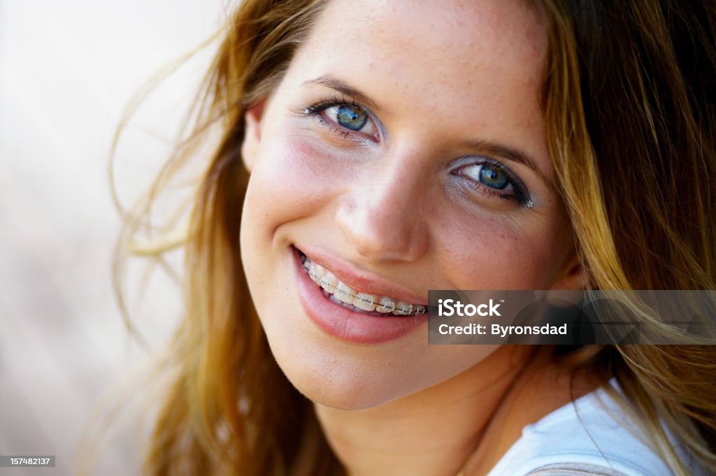 Adolescente sonriente con aparatos de ortodoncia - Foto de stock de Banda correctora libre de derechos