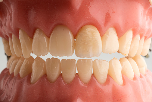 Plastic model of human jaw with white teeth.