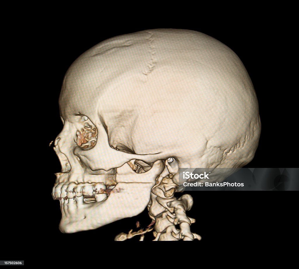 Crâne 3D vue latérale Tomographie axiale informatisée - Photo de Forme tridimensionnelle libre de droits