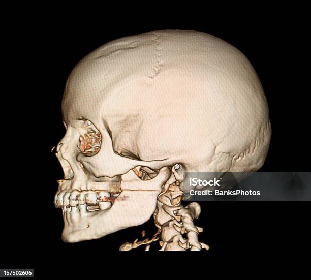 3 D Crânio Vista Lateral Tomografia Computorizada - Fotografias de stock e mais imagens de Tridimensional - Tridimensional, Imagem de raios X, Raio X