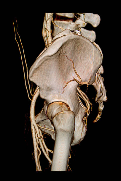 3 d lateral exame de tac com artérias da pélvis - x ray image coccyx radiologist hip imagens e fotografias de stock