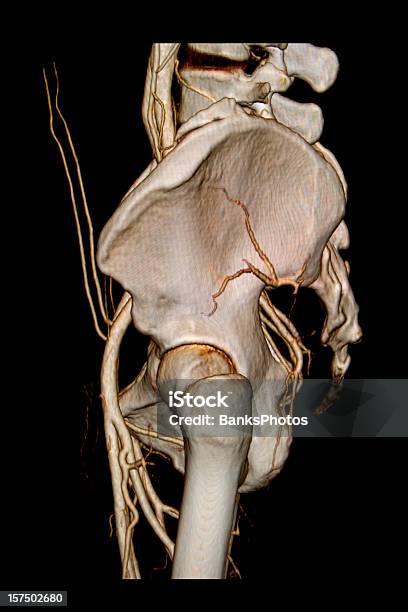 3 D Боковой Ктсканирование Органов Таза С Артерий — стоковые фотографии и другие картинки Рентгеновский снимок - Рентгеновский снимок, Таз, 3D сканирование