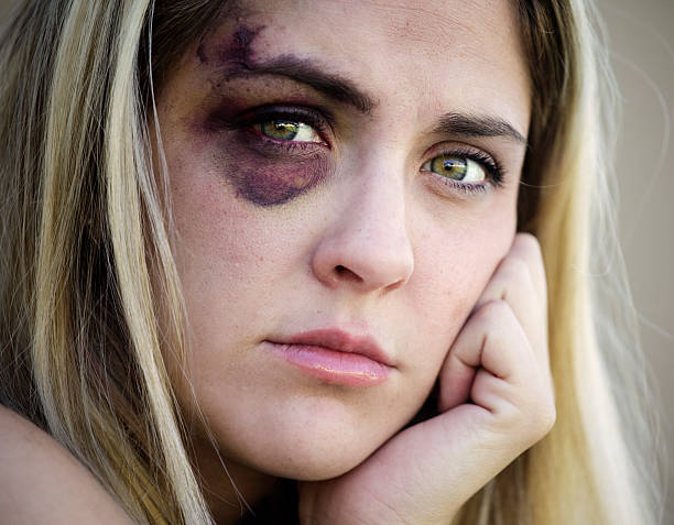 istock Black Eyed Woman 157508125