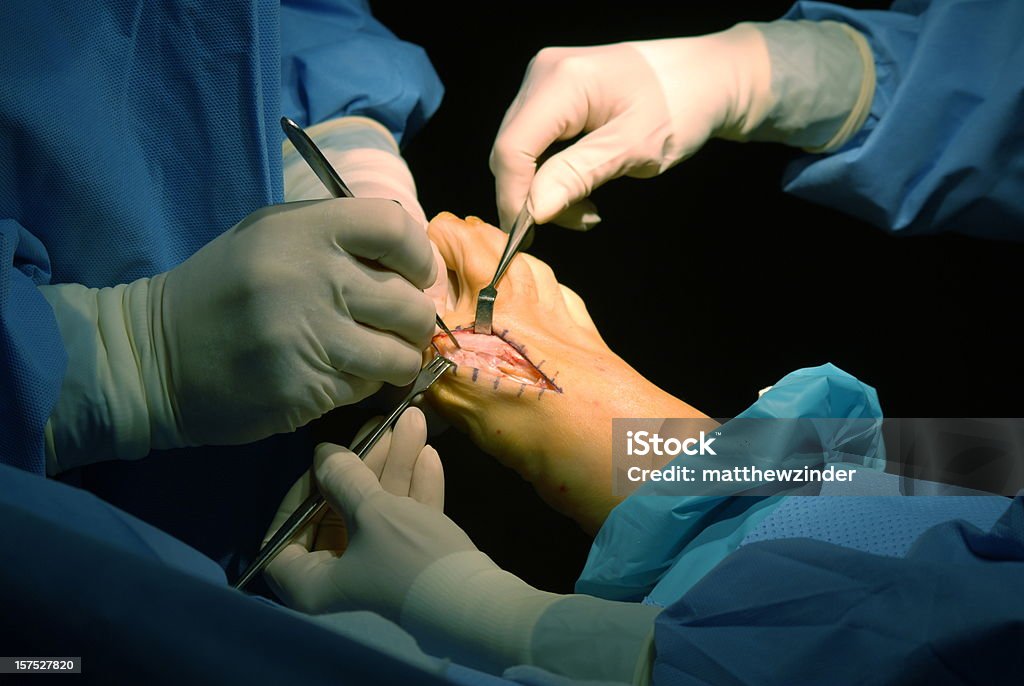 incision Podiatrist, - Lizenzfrei Operation Stock-Foto