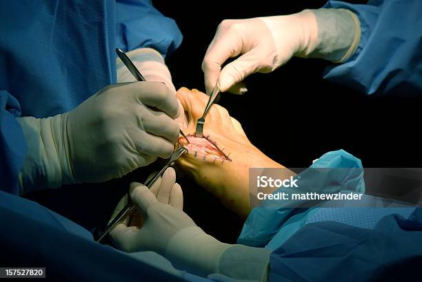 Incision Podiatrist Stockfoto und mehr Bilder von Operation - Operation, Skalpell, Ausrüstung und Geräte