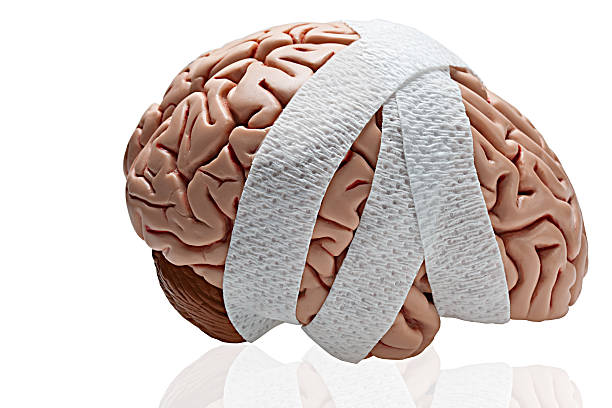 Brain Injury Gauze wrapped around a brain to symbolize a brain injury. concussion stock pictures, royalty-free photos & images