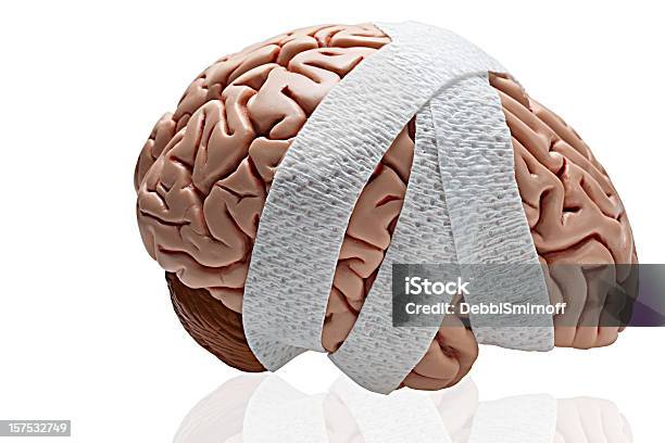 Brain Injury Stock Photo - Download Image Now - Brain Damage, Concussion, Shock
