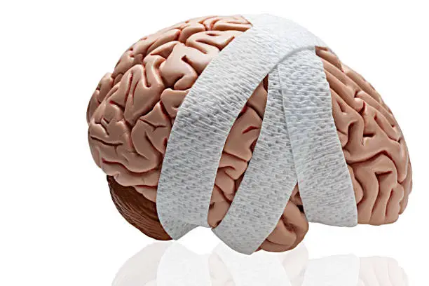 Photo of Brain Injury