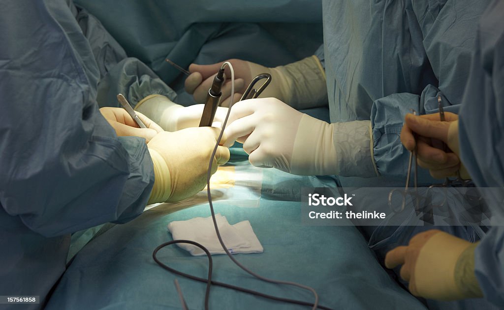 Close-up de uma cirurgia - Royalty-free Abdómen Foto de stock