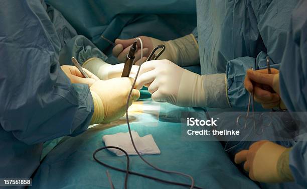 Closeup De Uma Cirurgia - Fotografias de stock e mais imagens de Abdómen - Abdómen, Cirurgia, Abdómen Humano