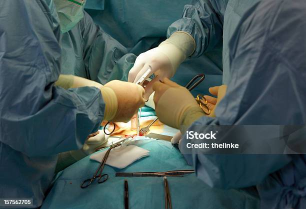 Closeup De Uma Cirurgia - Fotografias de stock e mais imagens de Cirurgia - Cirurgia, Abdómen, Abdómen Humano