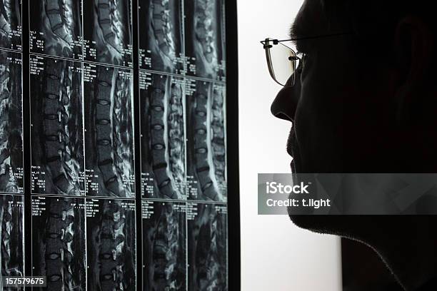 Doctor Mirando Mri Foto de stock y más banco de imágenes de Cirujano ortopédico - Cirujano ortopédico, Escáner IRM, Imagen de resonancia magnética