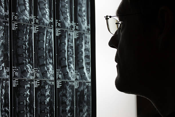 담담의 루킹 mri - human spine mri scan x ray doctor 뉴스 사진 이미지
