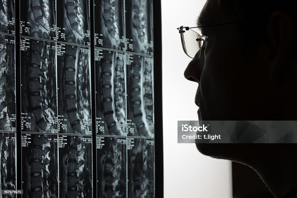 Врач осматривает МРТ - Стоковые фото Магнитно-резонансная томография роялти-фри