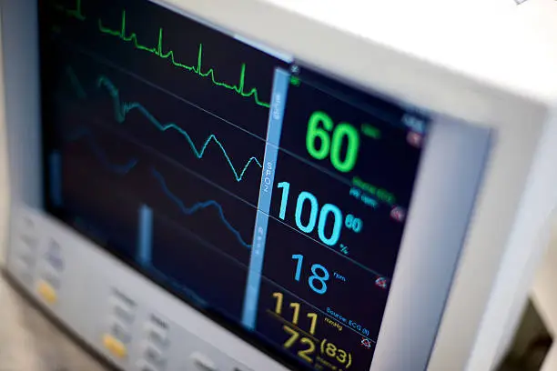 Photo of EKG hospital medical equipment vital statistics