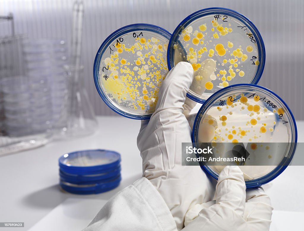 Serie di laboratorio con tre diverse culture concentrazione di batteri - Foto stock royalty-free di Agar