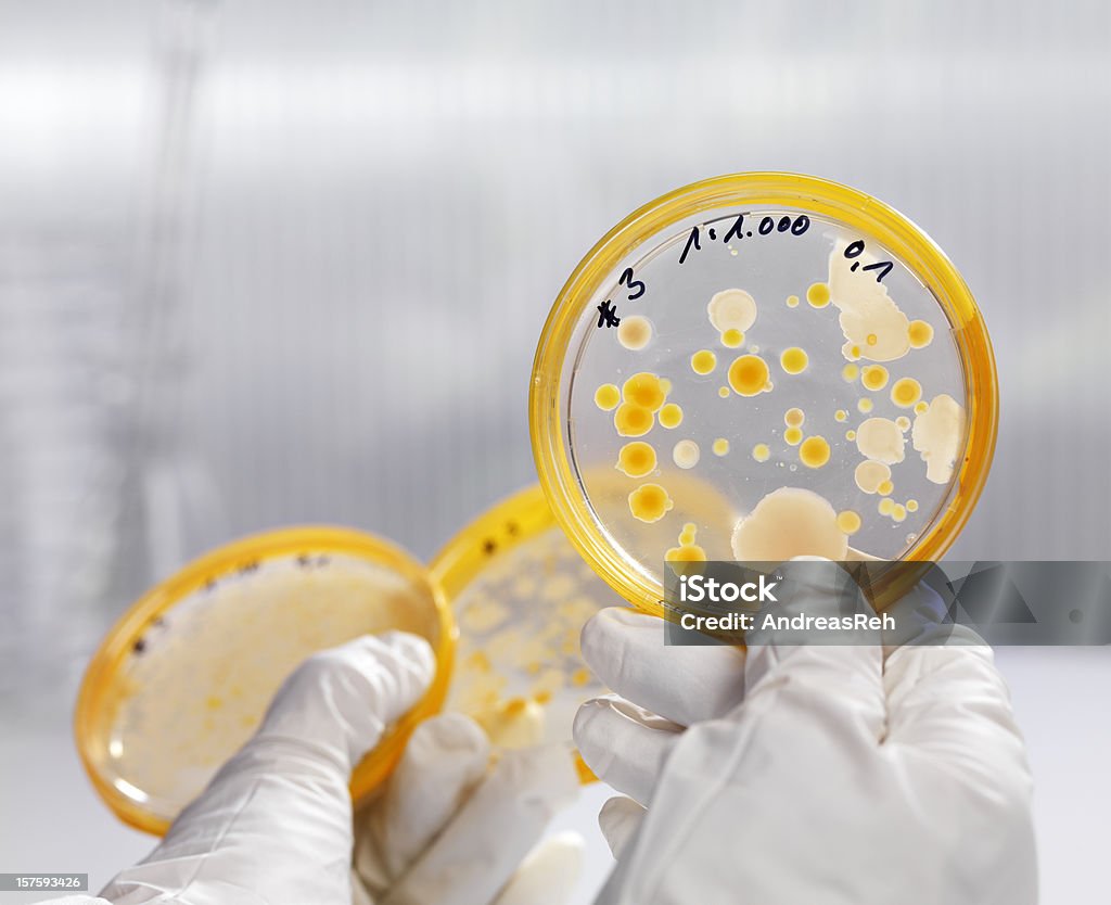 Analisi dei batteri culture - Foto stock royalty-free di Agar
