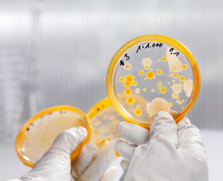 Laboratory dilution series of a clean culture of aerobic bacteria on agar plates. Selective focus on petri dish. AdobeRGB color profile. Content of my lightbox medical & sciences: