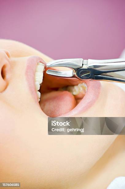 Visite A Cirurgia De Dentista - Fotografias de stock e mais imagens de Aberto - Aberto, Adulto, Alicate