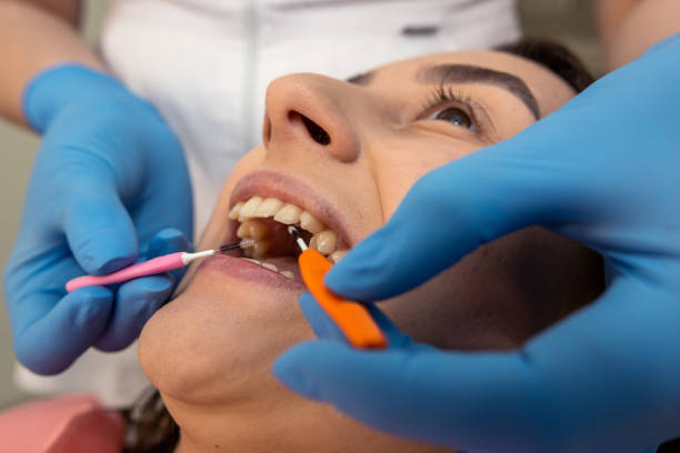 istock dentist use interproximal interdental brush for perfect clean teeth at clinic 1576068564