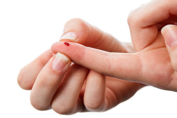 Diabetics drop of blood on finger A drop of blood is ready for a glucose level blood test.  surgical pin stock pictures, royalty-free photos & images