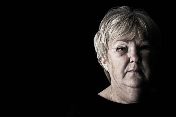 istock Injured Mature Woman 157613806