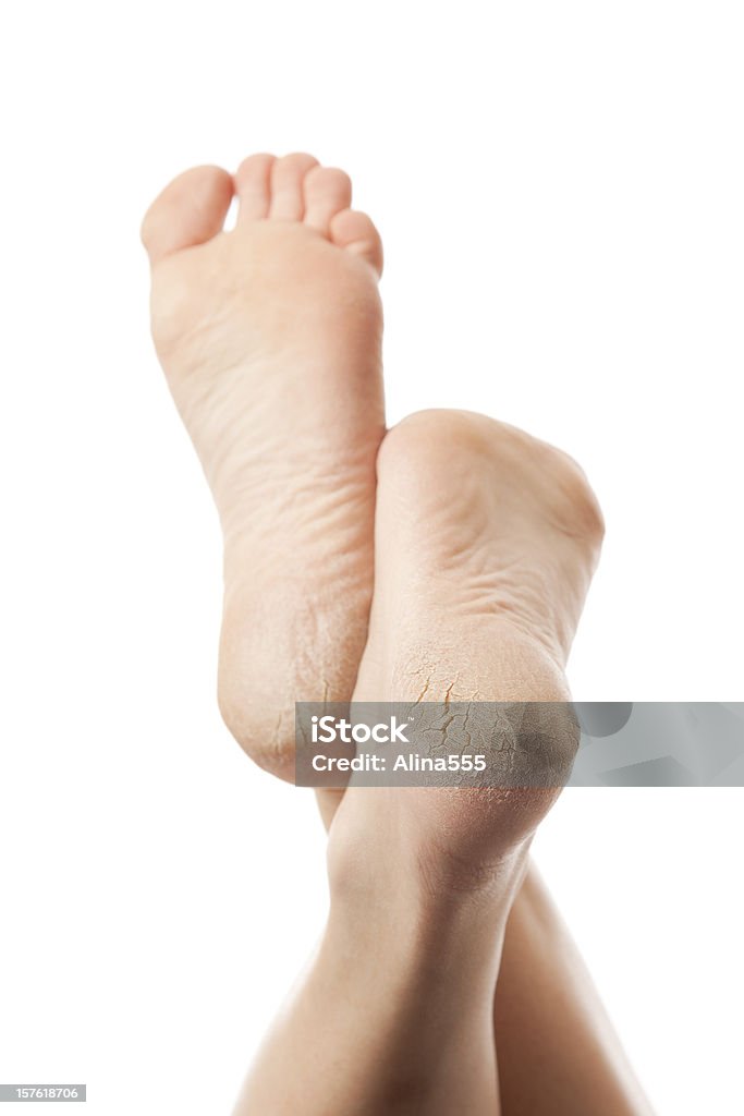 乾燥してヒビ割れた足の裏に白背景 - 人の足のロイヤリティフリーストックフォト