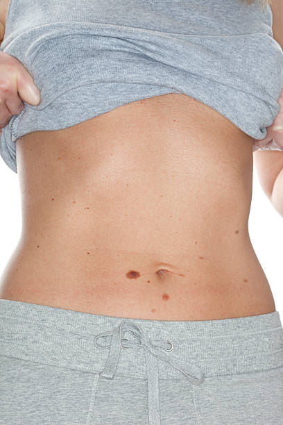 istock Skin cancer 157619690
