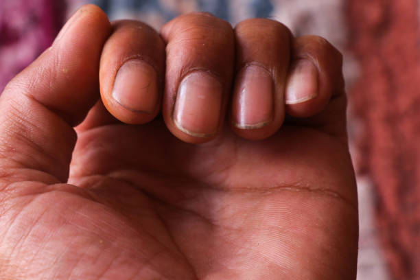 istock Close up of  hand with a nails in focus. 1576274969