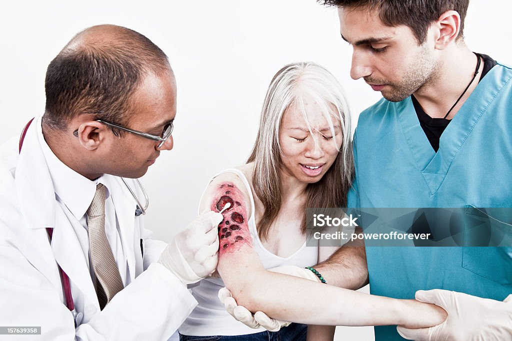 Équipe médicale traitent brûler Victime - Photo de Coton-tige libre de droits
