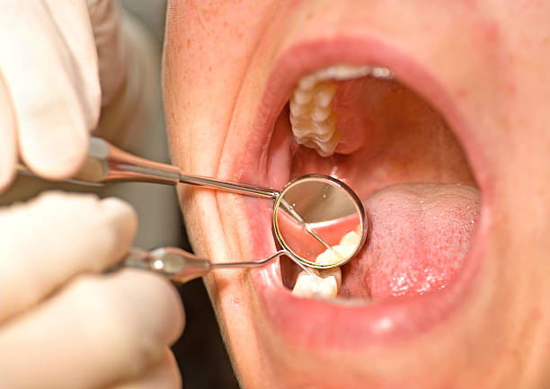 istock Patient at dentist with open mouth during treatment on teeth 157639828