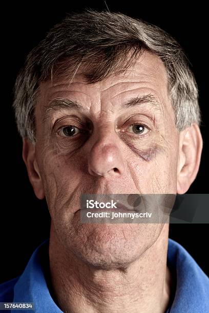 Blackeye Foto de stock y más banco de imágenes de Cara humana - Cara humana, Hombres mayores, Violencia