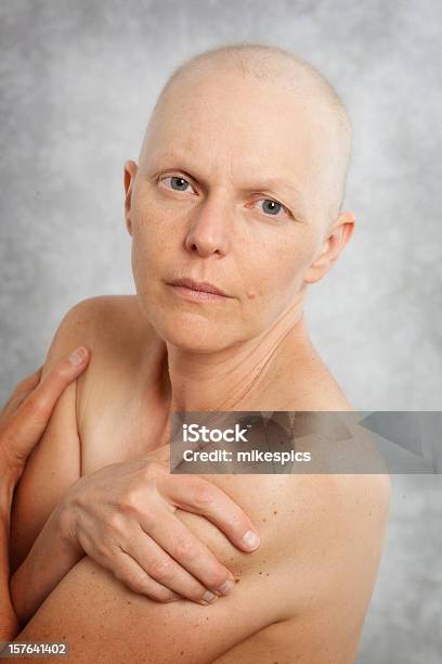 인물 사진 베어 하나의 유방암 환자 건강관리와 의술에 대한 스톡 사진 및 기타 이미지 - 건강관리와 의술, 결심, 만짐