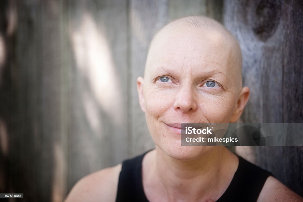 Calvície mulher luta contra o cancro da mama ao ar livre, olhando para fora da câmara. - Royalty-free Cancro Foto de stock