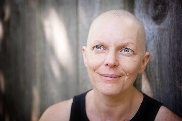 calvície mulher luta contra o cancro da mama ao ar livre, olhando para fora da câmara. - cancer chemotherapy drug patient women imagens e fotografias de stock
