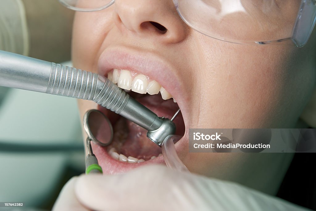 Dental operazione - Foto stock royalty-free di Adulto