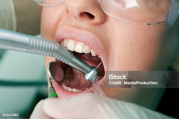 Dental Operazione - Fotografie stock e altre immagini di Adulto - Adulto, Ambulatorio dentistico, Aperto