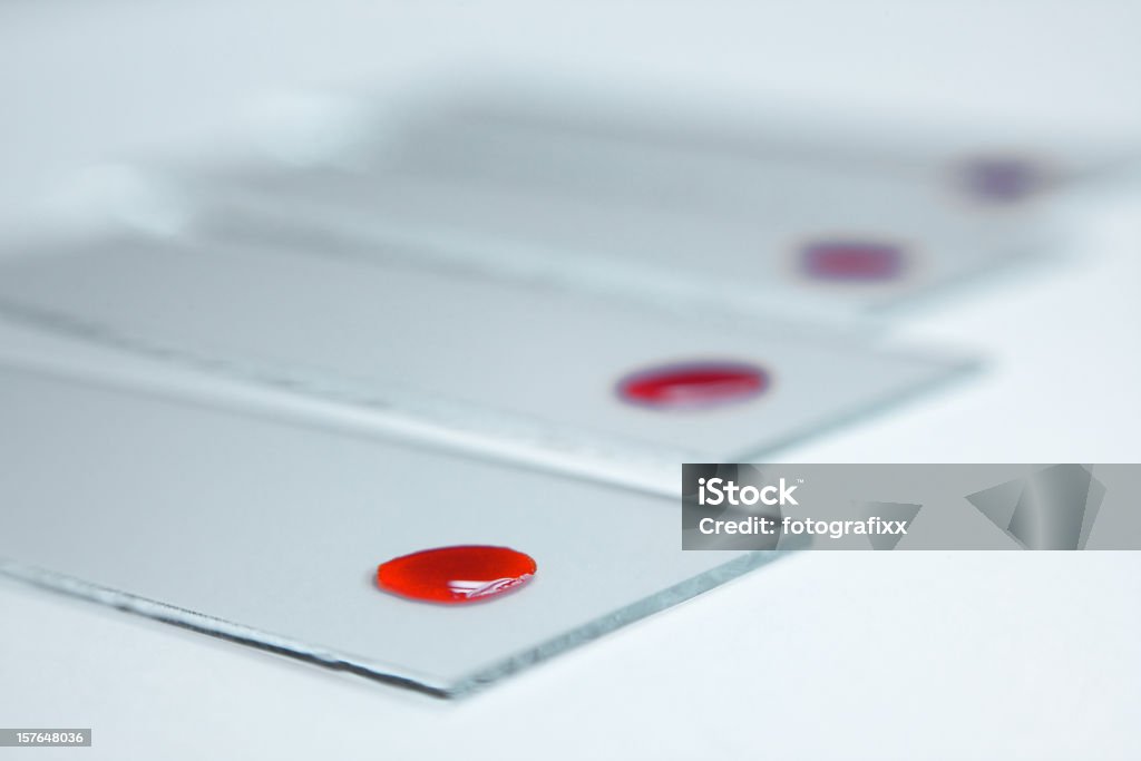 Primer plano de una muestra de sangre - Foto de stock de Análisis de sangre - Prueba médica libre de derechos