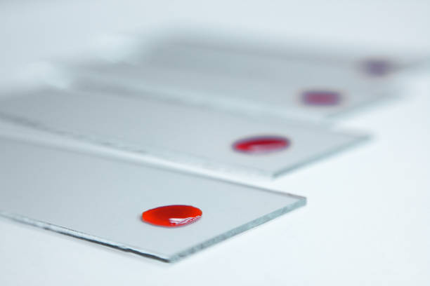 Blood Sample 